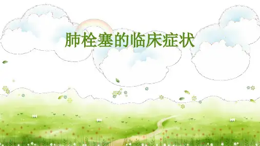 肺栓塞的临床症状