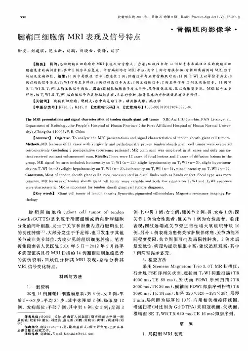腱鞘巨细胞瘤MRI表现及信号特点