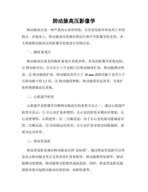 肺动脉高压影像学