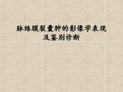 脉络膜裂囊肿的影像学表现及鉴别诊断