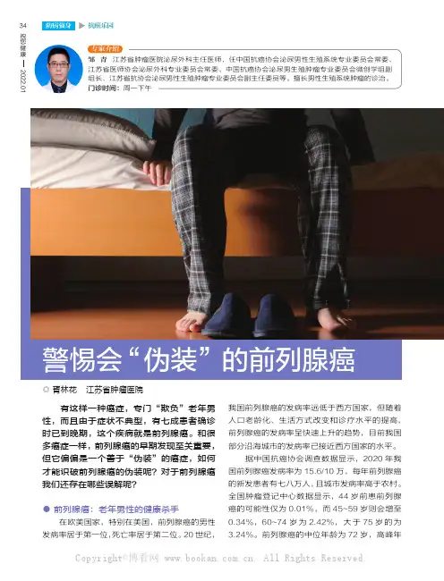 警惕会“伪装”的前列腺癌