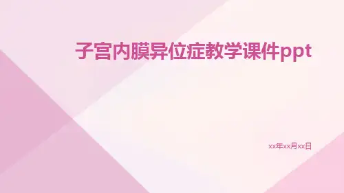 子宫内膜异位症教学课件ppt