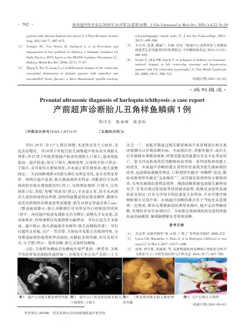产前超声诊断胎儿丑角样鱼鳞病1例