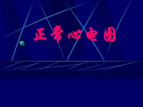 2、正常心电图