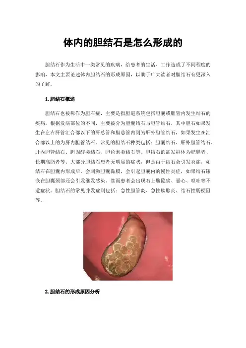 体内的胆结石是怎么形成的