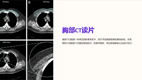 《胸部CT读片》课件