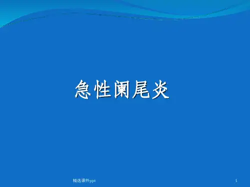 《急性阑尾炎》PPT课件