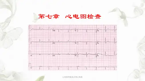 心电图导联及正常心电图ppt课件