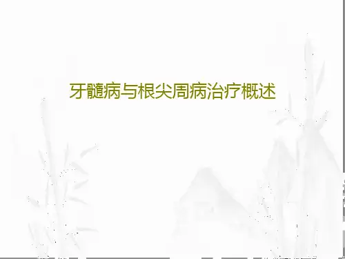 牙髓病与根尖周病治疗概述课件