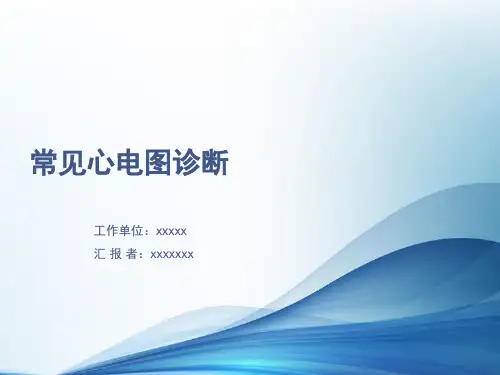 常见心电图诊断