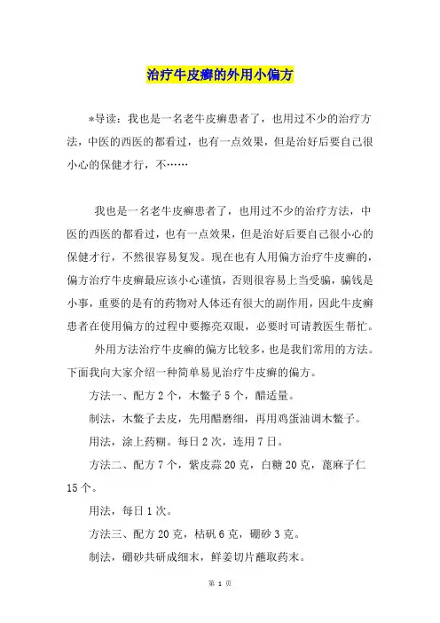 治疗牛皮癣的外用小偏方