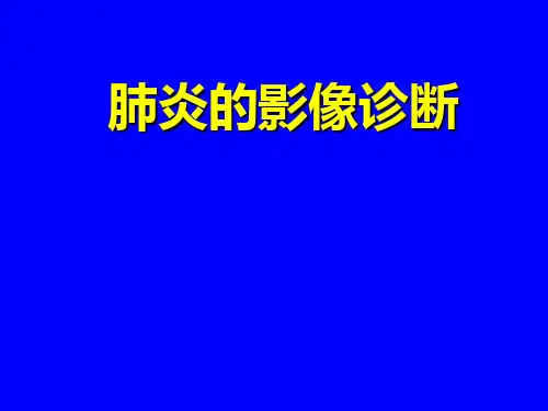 肺炎的影像学诊断
