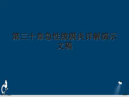 第三十章急性腹膜炎详解演示文稿
