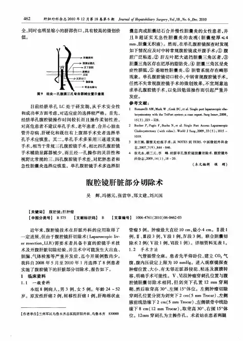 腹腔镜肝脏部分切除术