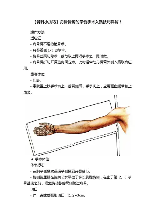 【骨科小技巧】舟骨骨折的掌侧手术入路技巧详解！