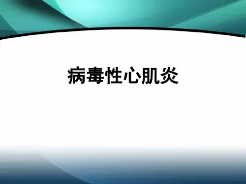 病毒性心肌炎