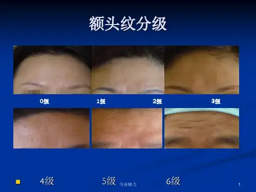 皱纹分级[高级教资]