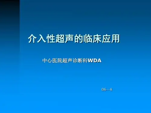 介入性超声