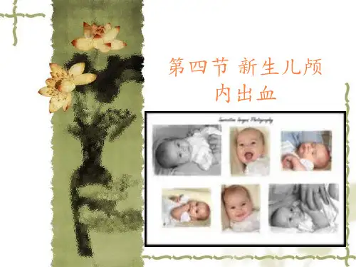 第四节新生儿颅内出血PPT课件
