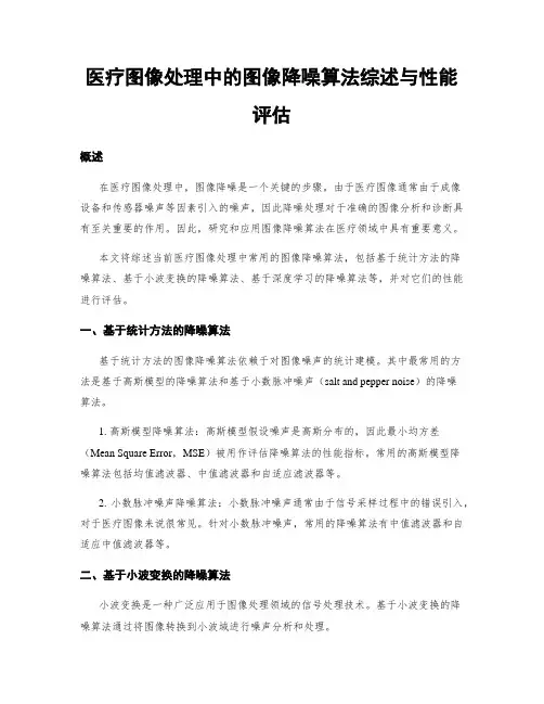 医疗图像处理中的图像降噪算法综述与性能评估