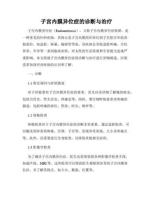 子宫内膜异位症的诊断与治疗