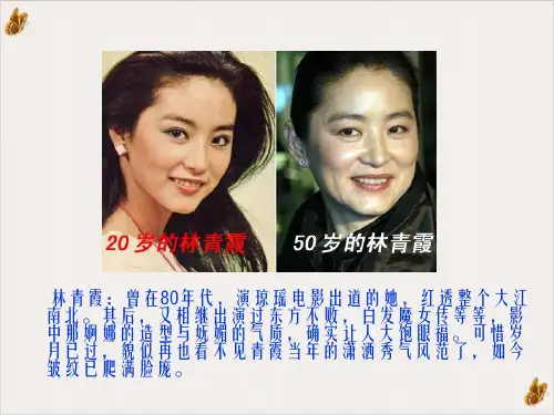 绝经过渡期激素补充治疗PPT课件(模板)