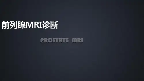前列腺MRI诊断