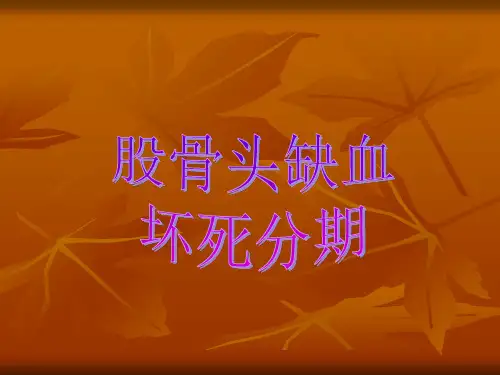 股骨头坏死分期