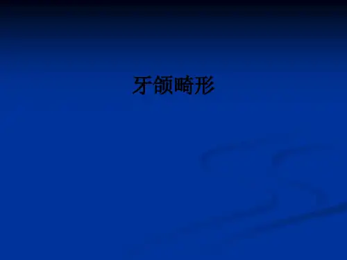 牙颌畸形ppt课件