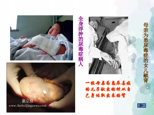 苏教版-生物-七年级下册- 4.11.1人体泌尿系统的组成课件