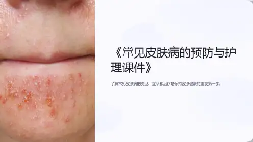 《常见皮肤病的预防与护理课件》