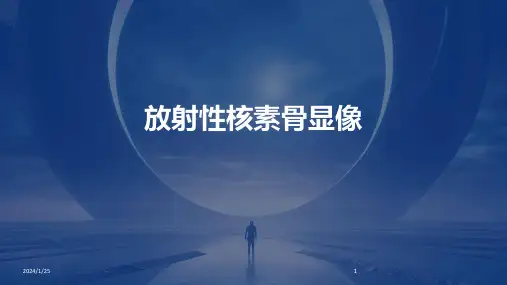 放射性核素骨显像