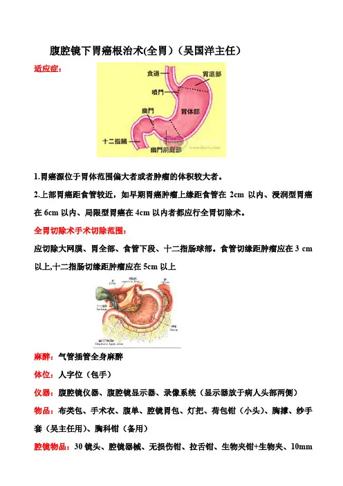 腔镜下全胃切除术手术步骤