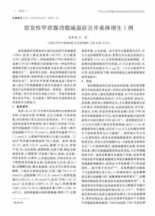 原发性甲状腺功能减退症合并垂体增生1例