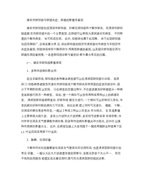 继发性肺结核与肺部炎症、肺癌的影像学鉴别讲解