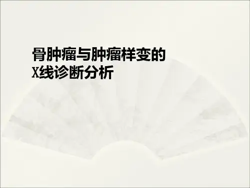 骨肿瘤鉴别诊断攻略ppt课件