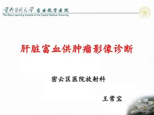 肝脏富血供病变