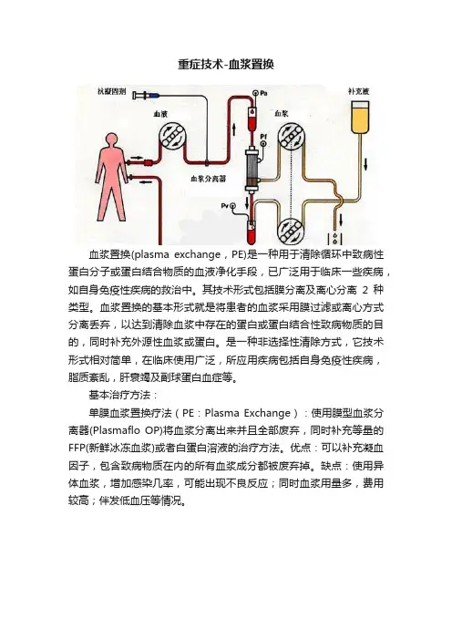 重症技术-血浆置换