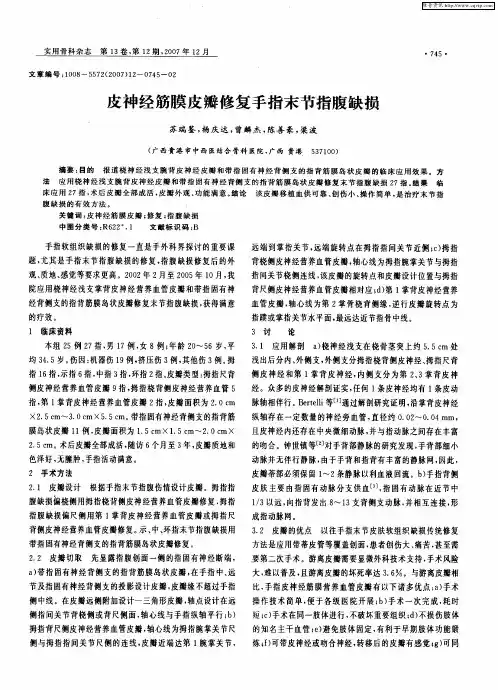 皮神经筋膜皮瓣修复手指末节指腹缺损