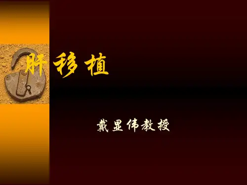 肝移植