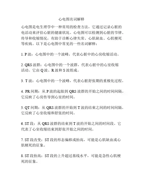 心电图名词解释
