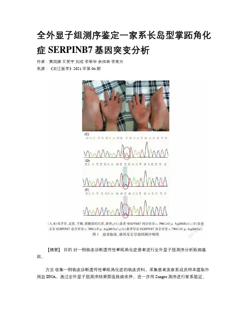 全外显子组测序鉴定一家系长岛型掌跖角化症SERPINB7基因突变分析