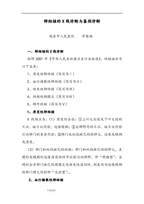 肺结核的X线诊断与鉴别诊断