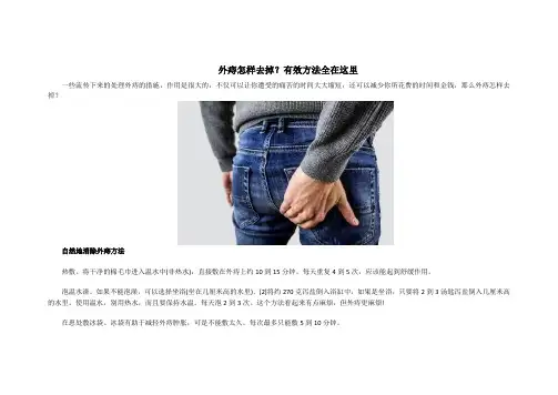 外痔怎样去掉？有效方法全在这里