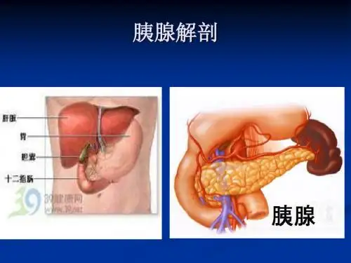 高脂血症性胰腺炎_图文