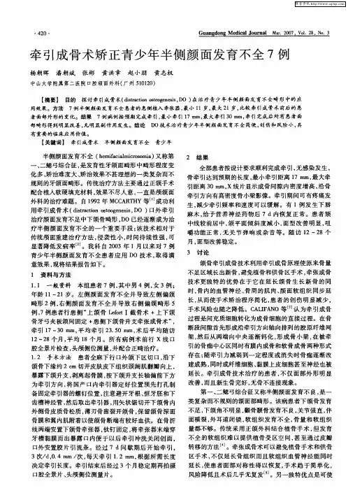牵引成骨术矫正青少年半侧颜面发育不全7例