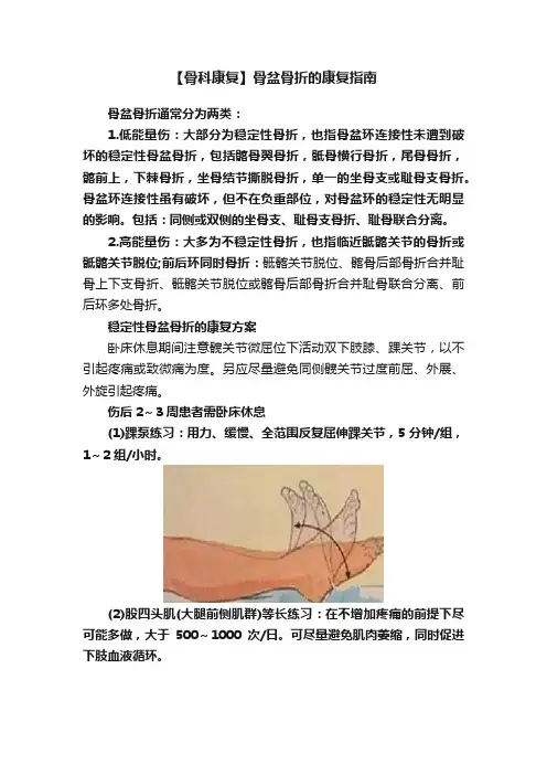 【骨科康复】骨盆骨折的康复指南
