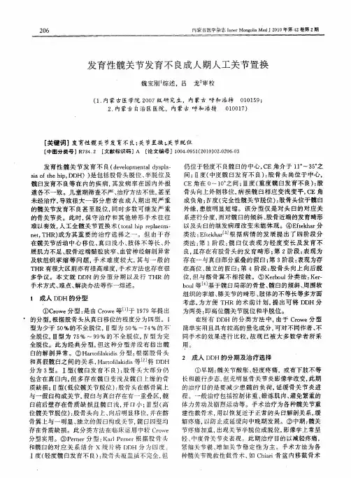 发育性髋关节发育不良成人期人工关节置换