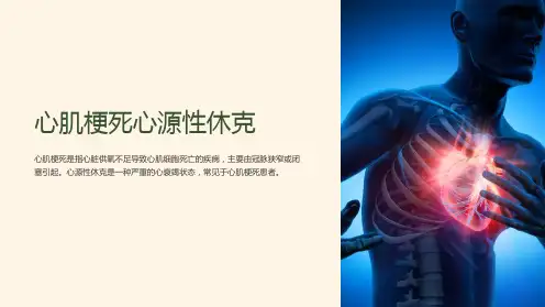 心肌梗死心源性休克