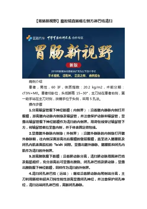 【胃肠新视野】腹腔镜直肠癌左侧方淋巴结清扫